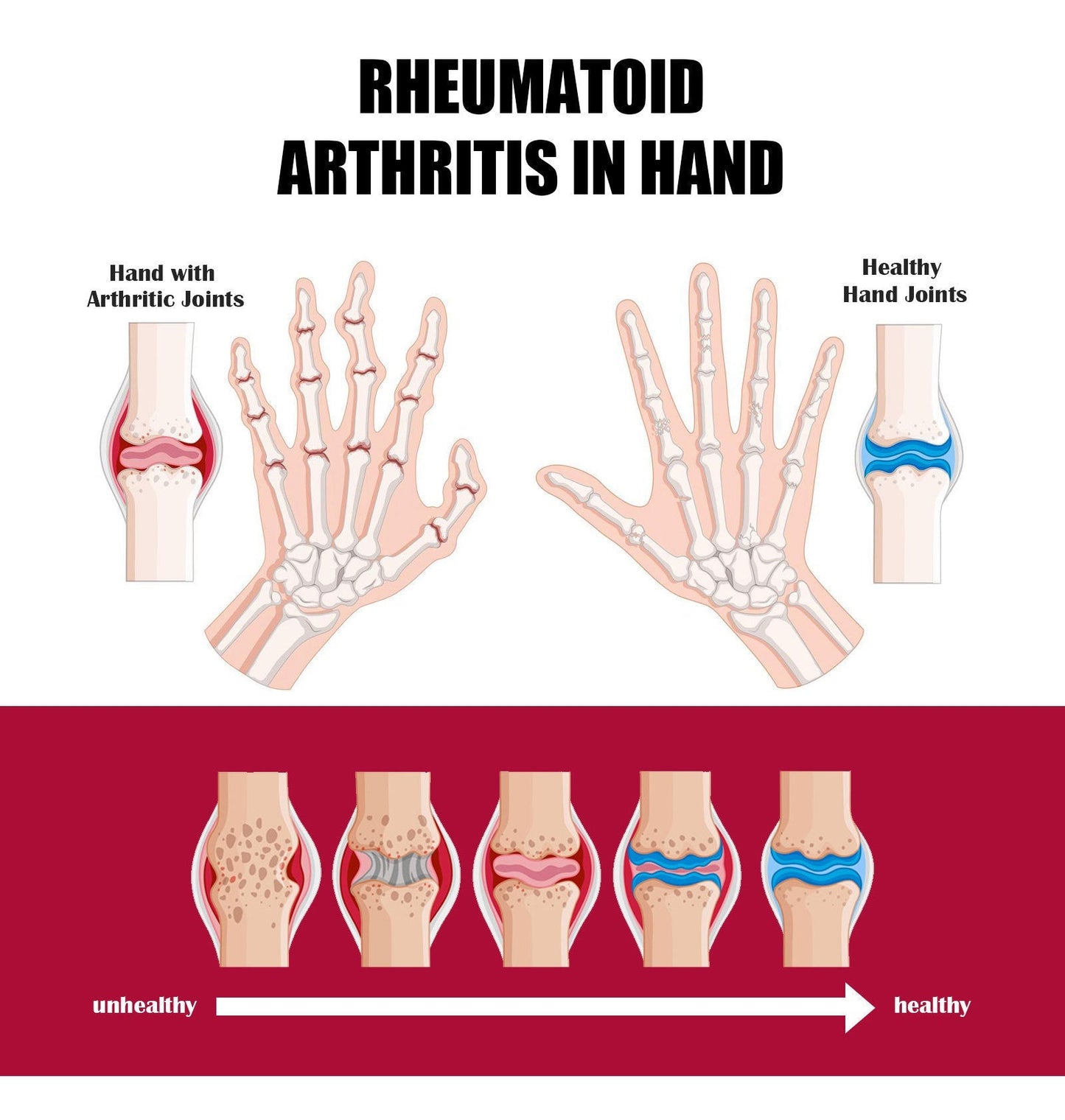 ๐ Beevana Bee Venom Cream โ Natural Relief for Your Joints and Bones ๐ฏ Exclusive Offer Today: Buy 2 Get 1 Free!