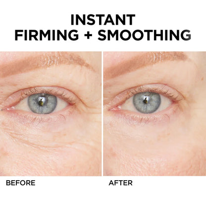 🚨𝑳𝑨𝑺𝑻 𝑫𝑨𝒀 𝑫𝑰𝑺𝑪𝑶𝑼𝑵𝑻: 𝟖𝟕% 𝑶𝑭𝑭 🔥 Instant Wrinkle Eye Tightener Cream