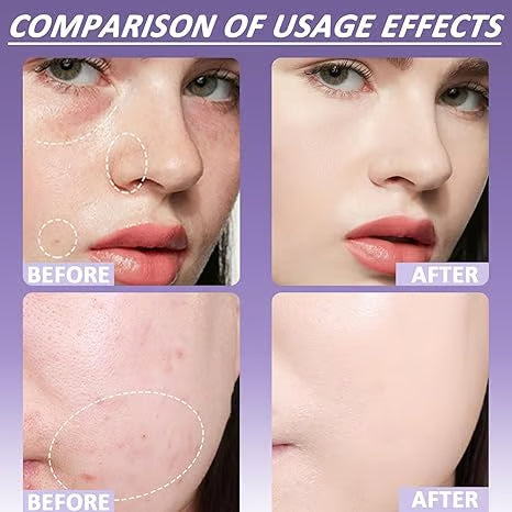 🔥 Soft Matte Cream Concealer