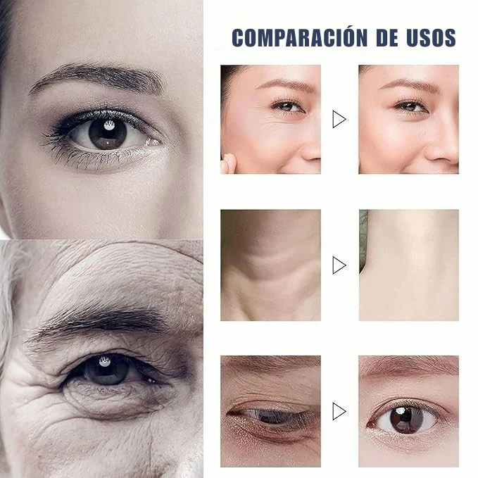✨ ¡Borrador de Arrugas Sin Agujas! 50% DTO. | Resultados en 2 Semanas | Stock Limitado ⏳