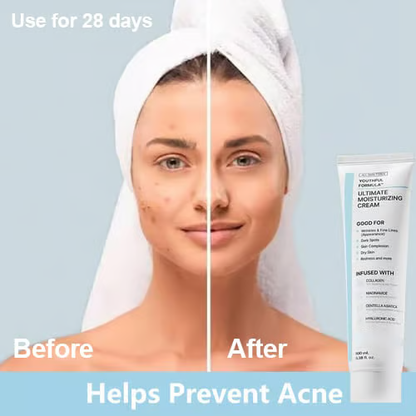 🎉Hot Sale 49% OFF🎉-Youthful Formula Ultimate Moisturizing Cream