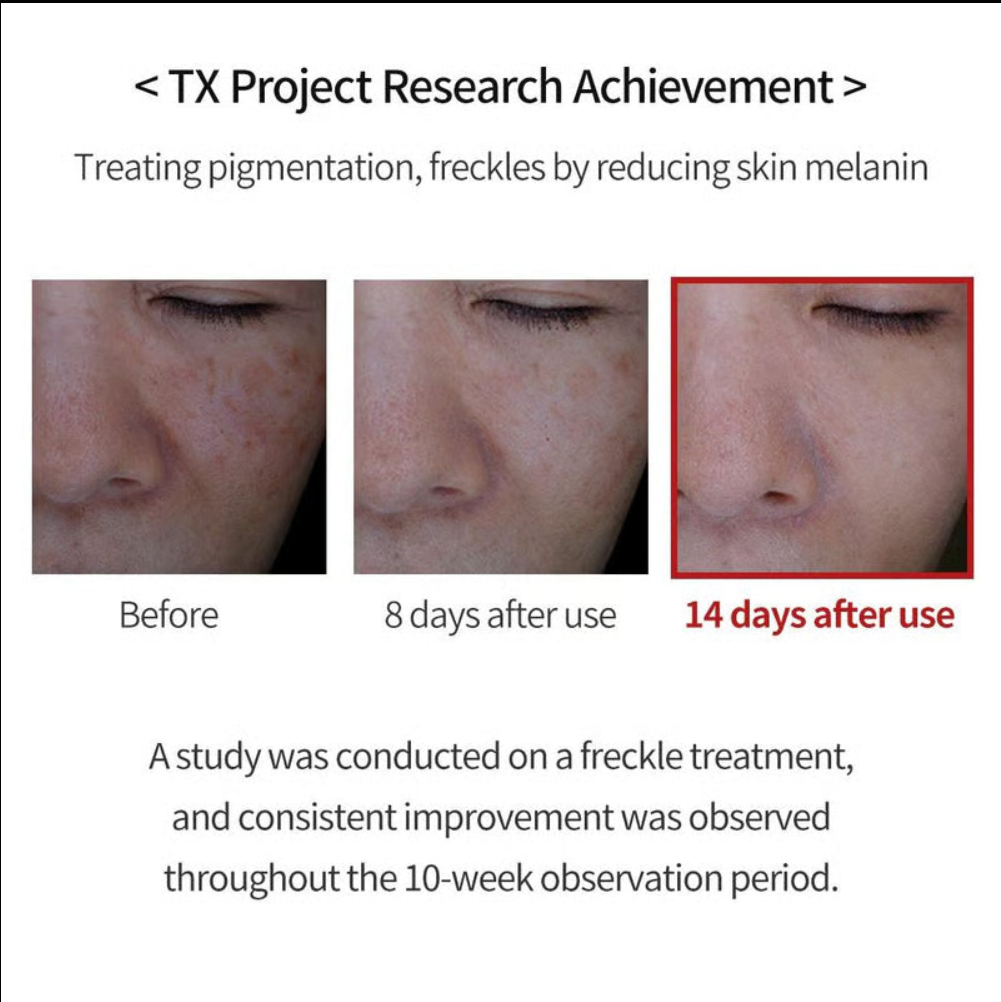 TX Cream -for Dark Spots & Hyperpigmentation