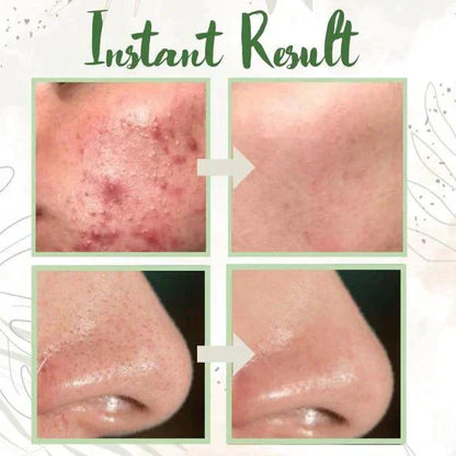 MatchaGlow™ – Clarifying Face Mask